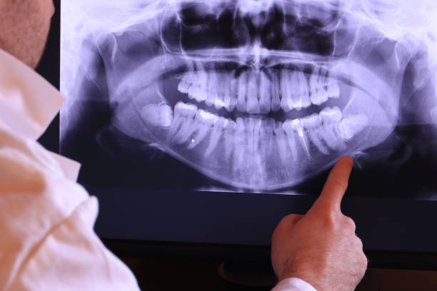 Best After-Hours Emergency Dentist in Tomball, TX