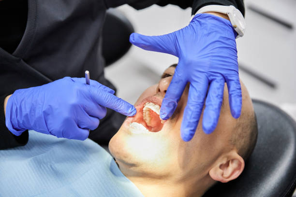 Best Emergency Wisdom Teeth Removal in Tomball, TX